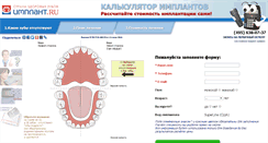Desktop Screenshot of calc.implant.ru